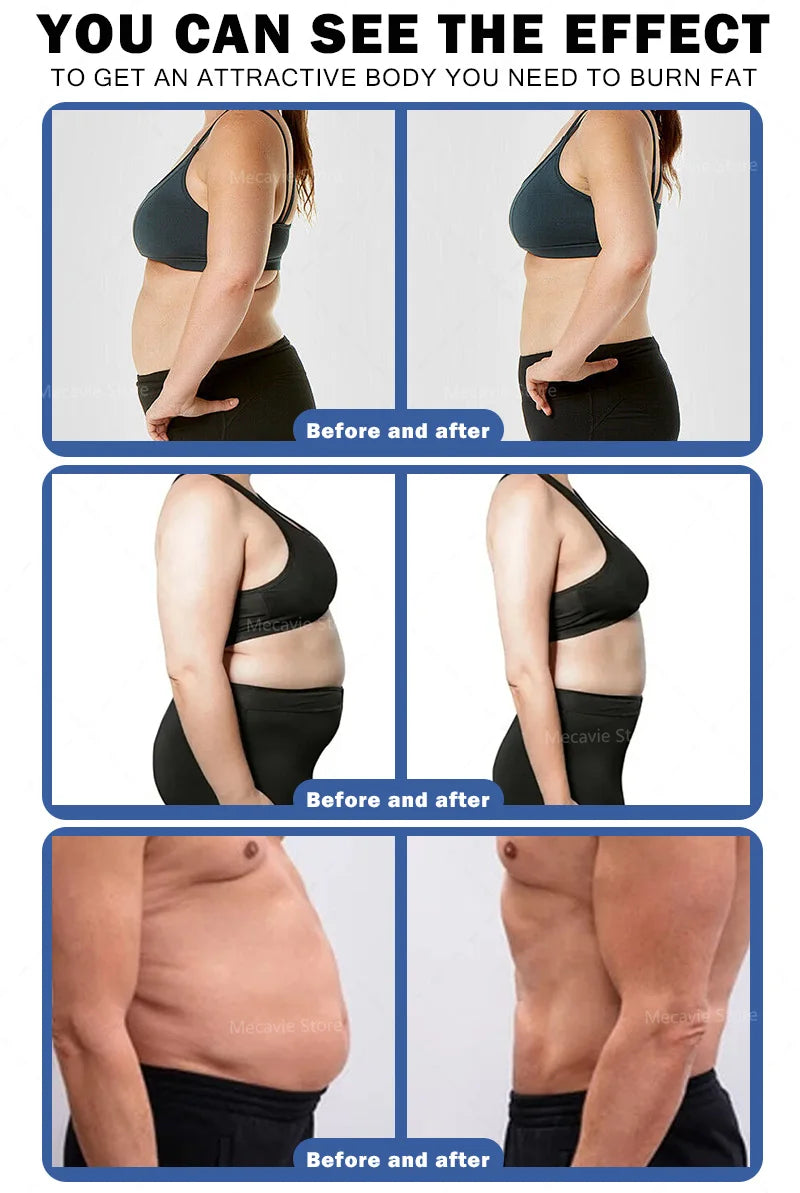 2026 Tecnología RF Estimulación muscular Reducción de grasa Equipo de belleza para adelgazar de cuerpo de alta intensidad 6500W